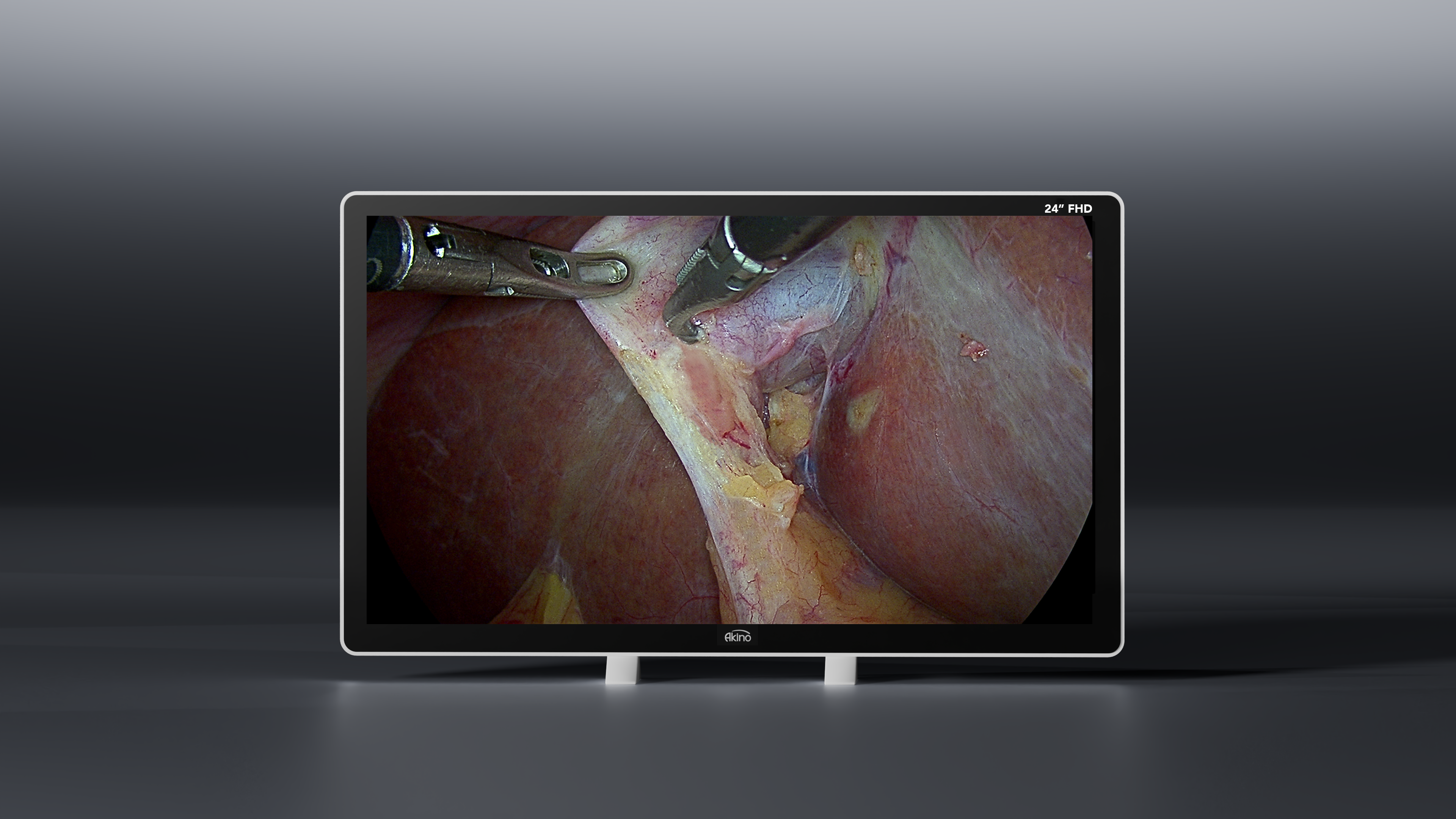 24” - Full HD, 1920x1200