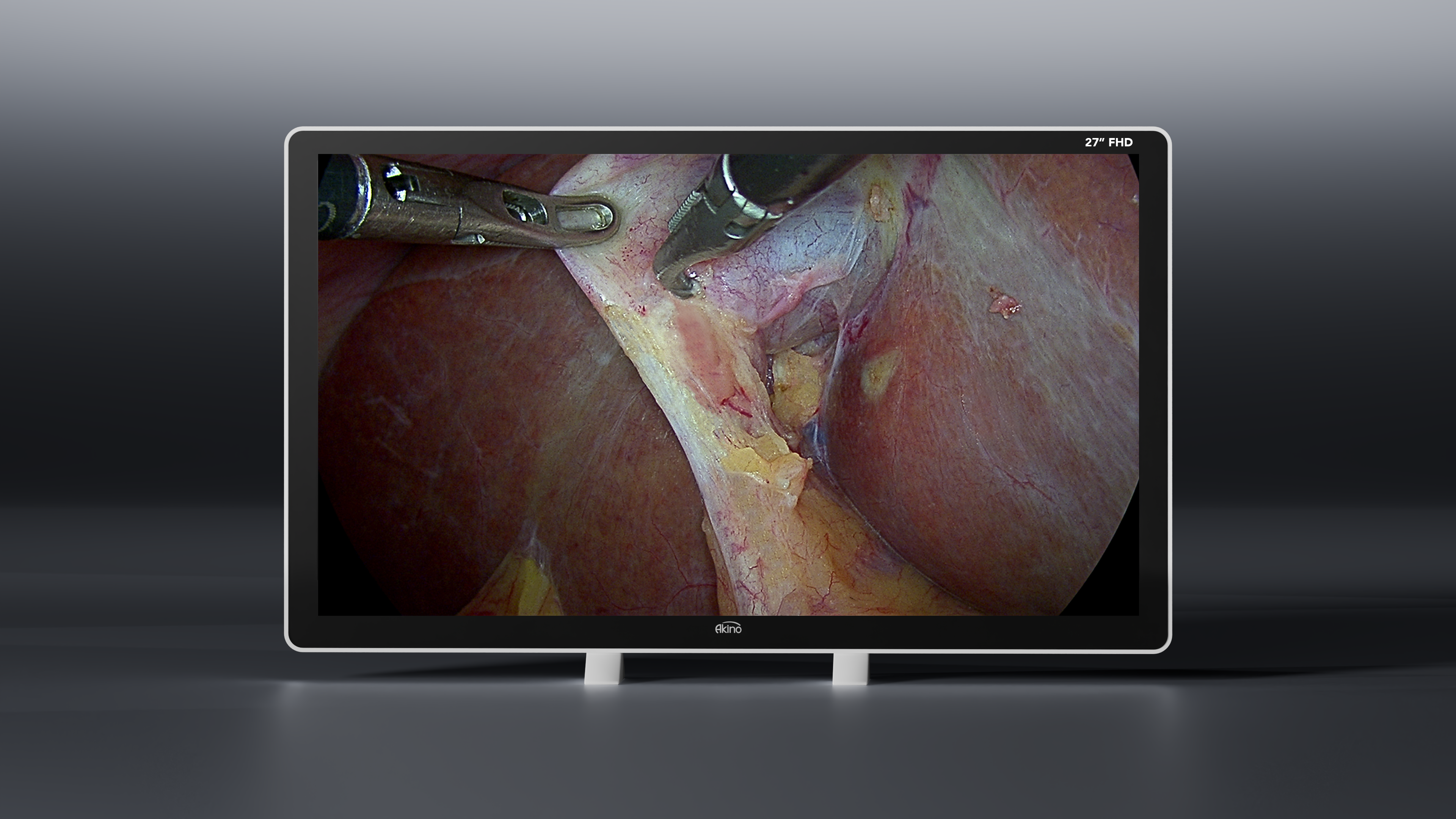 27” - Full HD, 1920x1080